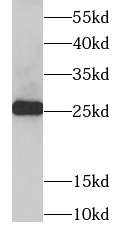 TPI1 antibody|TPI1抗体 FNab08886