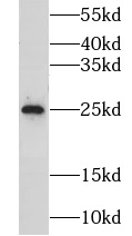 CIDEA antibody|CIDEA抗体