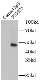 PLOD2-Specific antibody|PLOD2抗