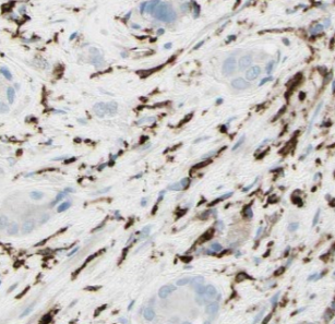 MCPH1 antibody|MCPH1抗体