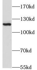 JMY antibody|JMY抗体