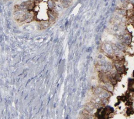 TIMM23 antibody|TIMM23抗体