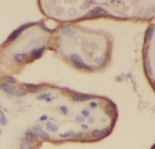 ITGB1 antibody|ITGB1抗体