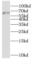 SLC19A3 antibody|SLC19A3抗体