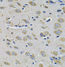 RAB17 antibody|RAB17抗体