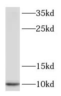 S100A1 antibody|S100A1抗体