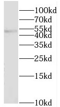 SGK2 antibody|SGK2抗体