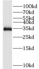 TEX264 antibody|TEX264抗体
