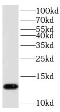PHF5A antibody|PHF5A抗体
