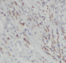 SSR2 antibody|SSR2抗体