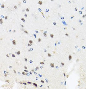 PRPF8 antibody|PRPF8抗体