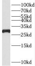 RPS4Y1 antibody|RPS4Y1抗体