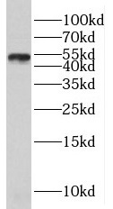 SUV39H2 antibody|SUV39H2抗体