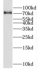 FUS antibody|FUS抗体 FNab03242
