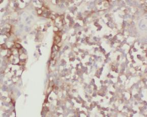 SKIC3 antibody|SKIC3抗体