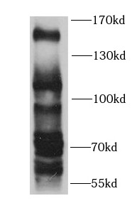 KDM4A antibody|KDM4A抗体