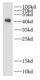 DHH antibody|DHH抗体 FNab02366