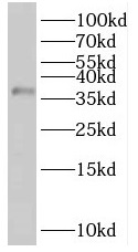 RIBC2 antibody|RIBC2抗体