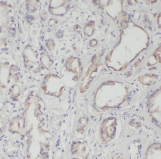 RPL18A antibody|RPL18A抗体 FNab0