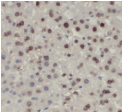 TXN antibody|TXN抗体