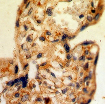 CSF2RA antibody|CSF2RA抗体