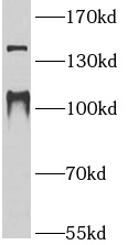 GRM1 antibody|GRM1抗体