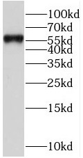 SERPIND1 antibody|SERPIND1抗体