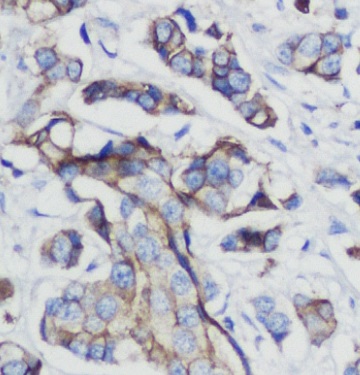 TGFBR2 antibody|TGFBR2抗体