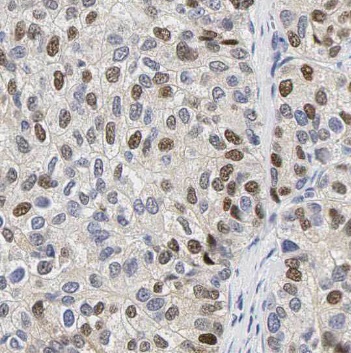 OAS2 antibody|OAS2抗体 FNab05951