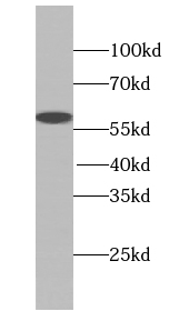 SEPSECS antibody|SEPSECS抗体