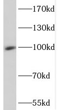 SP100 antibody|SP100抗体