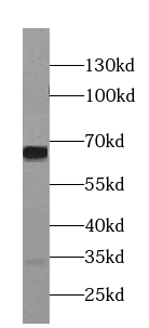 NELFB antibody|NELFB抗体