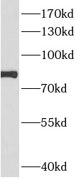 ARPP21 antibody|ARPP21抗体