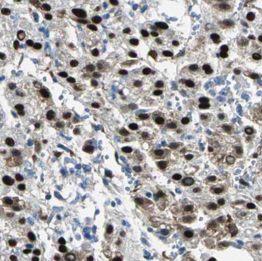 PPP4R2 antibody|PPP4R2抗体