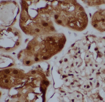 TBX2 antibody|TBX2抗体 FNab08536