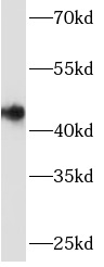 ARSB antibody|ARSB抗体