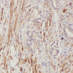 BCL2L14 antibody|BCL2L14抗体