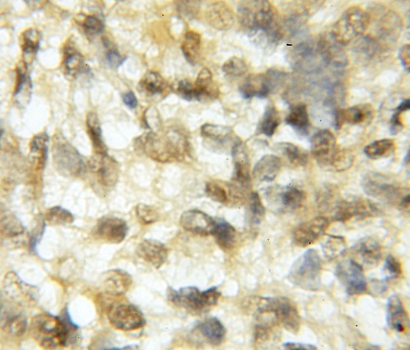 ROBO3 antibody|ROBO3抗体