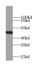 VPS4B antibody|VPS4B抗体