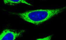 TXNDC16 antibody|TXNDC16抗体