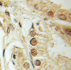 DEDD antibody|DEDD抗体