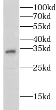 GSTZ1 antibody|GSTZ1抗体