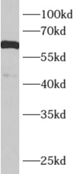 KCNJ3 antibody|KCNJ3抗体