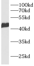 CACNG7 antibody|CACNG7抗体