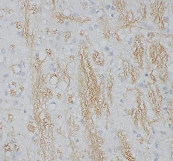 Spermine antibody|Spermine抗体