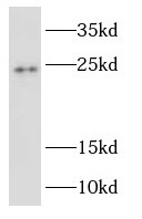 RAB2B antibody|RAB2B抗体