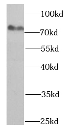 HADHA antibody|HADHA抗体 FNab037