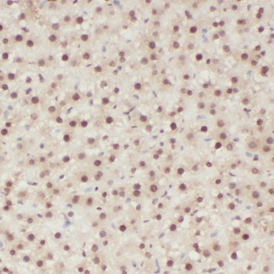 CLYBL antibody|CLYBL抗体