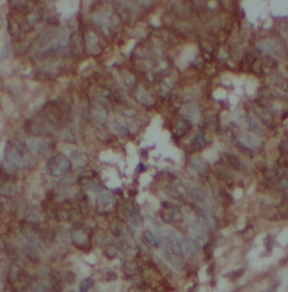 TTK antibody|TTK抗体