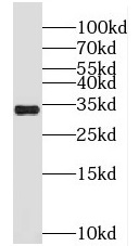 MLX antibody|MLX抗体